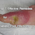 Top 7 Effective Remedies for Diabetic Foot Infections