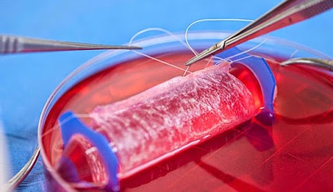 NOVIDADE: Vaginas criadas em laboratório são implantadas com sucesso em quatro pacientes