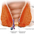 Buah Untuk Obat Buang Air Besar Berdarah thumbnail