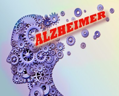 Empat Cara Mudah Bantu Cegah Alzheimer