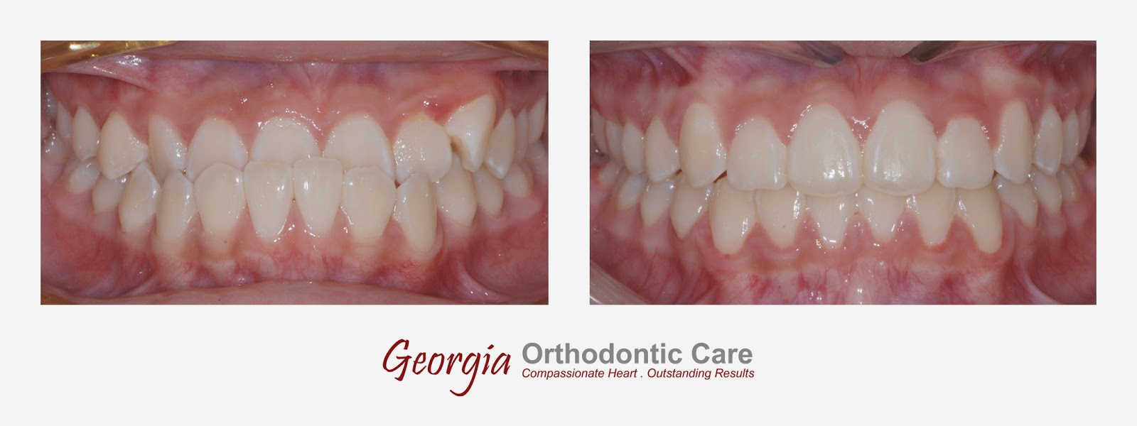 ORTHODONTIC CARE LAWRENCEVILLE & NORCROSS GA December 2014