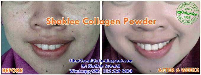 Testimoni Shaklee Collagen Powder (SCP) - Jeragat Hilang, Kulit Lebih Halus Selepas 6 Minggu