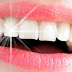 خلطات وطرق تبييض الأسنان طبيعيا بالمنزل بسرعة