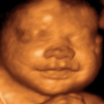 ultrasound