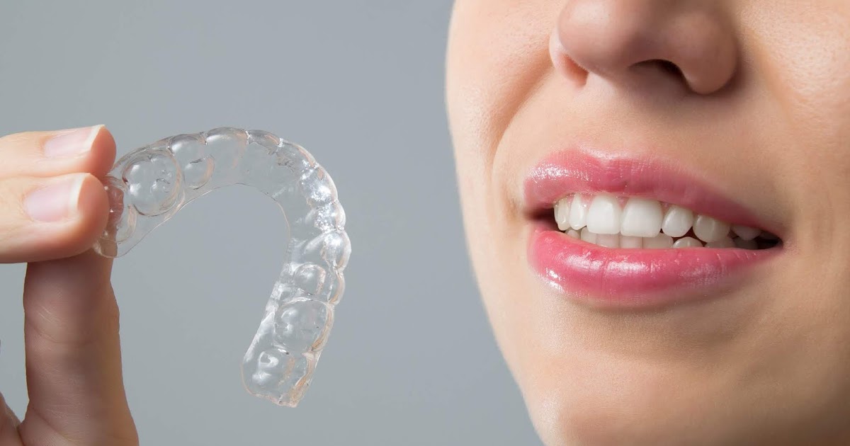 Buying the Right Braces for Your Teeth Some Tips