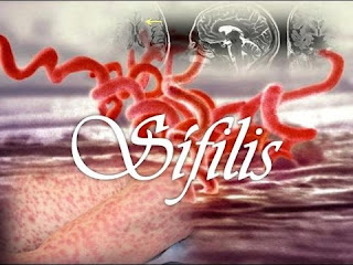 Image Menyembuhkan sipilis dengan obat De nature