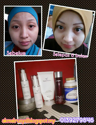 Testimoni pengguna yang berpuas hati dengan keberkesan produk kulit Shaklee mengatasi masalah kulit yang dihadapinya