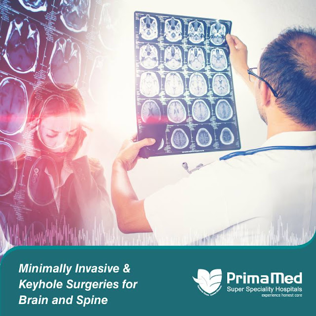 Hospital for Brain Stroke Treatment in Delhi Vimhans Hospital