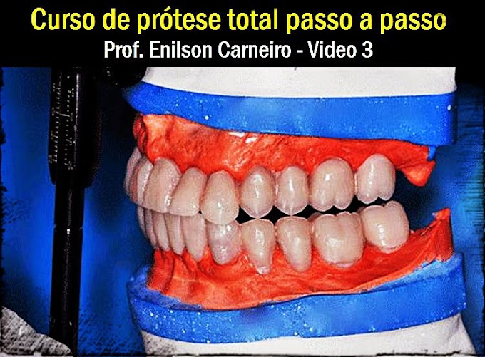 MONTAGEM DOS DENTES: Curso passo a passo - Video 3