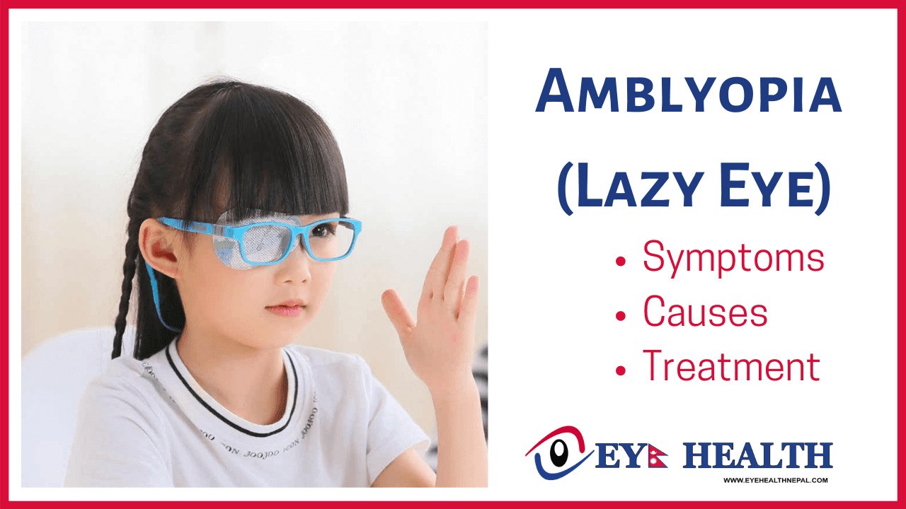 what happens if amblyopia is left untreated