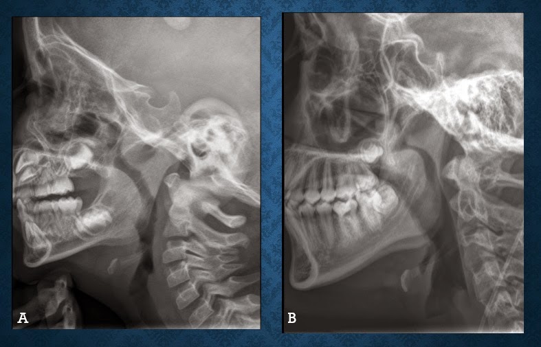ESPE 202 - 2014: Anatomía y patología de cuello