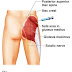 6 Reasons Doctors And Nurses Love To Inject The Buttocks More