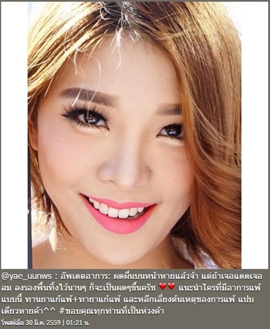 My Image 33