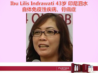 IBU LILIS INDRAWATI (43) SURABAYA-AUTO IMMUNE SYSTEM ATTACK BONE