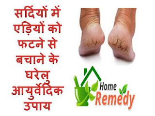 ediya-fatne-ka-gharelu-upchar ediya-fatne-ka-gharelu-upchar