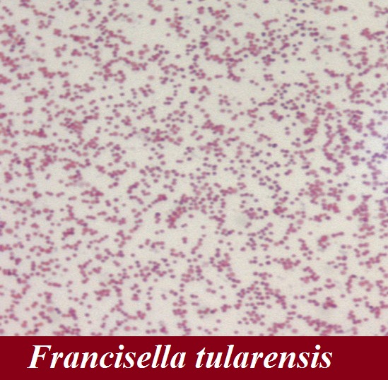 Молочница бактерии. Туляремия Francisella tularensis. Francisella tularensis под микроскопом. Francisella tularensis морфология.