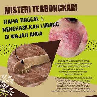 muka king sabun terbaik untuk kulit jeragat dan sensitif muka king sabun terbaik untuk kulit jeragat dan sensitif