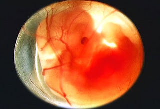 Conception to Birth Conception to Birth
