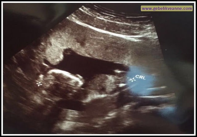 17 haftalık bebek görüntüsü
