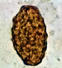 Ascaris petesejtek a vizeletben férgek hogyan lehet megtalálni