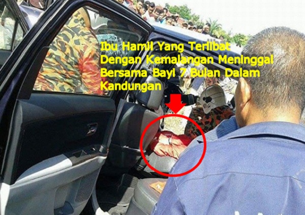 Guru Kemalangan, Maut Bersama Bayi 7 Bulan Dalam Kandungan - Media Sensasi