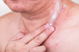 Facial Exercises Asian man applying antibiotic cream onto wound from removed mole via skin graft.