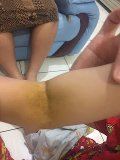 gambar testimoni psoriasis sembuh dengan seabuchthorn sbe sofgel gambar testimoni psoriasis sembuh dengan seabuchthorn sbe sofgel