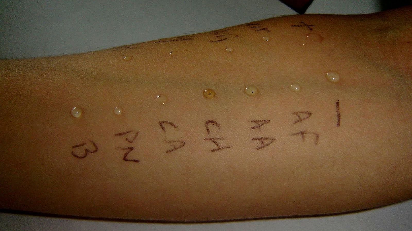 What Makes You Allergic To Cats Cat Choices