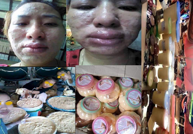 Waspada... Inilah Daftar Krim Pemutih Wajah yang Berbahaya