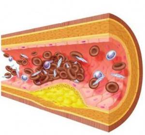 Obat Trigliserida