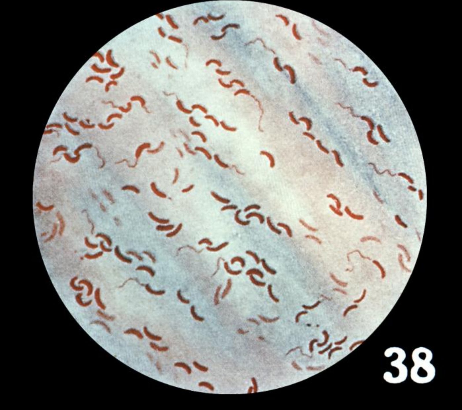 Трутовик окаймленный холерный вибрион. Холерный вибрион колонии. Холерный вибрион микробиология. Вибрион холеры под микроскопом.