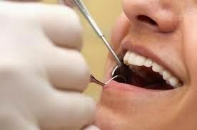Penyebab Gigi Keropos Erosi Mencegahnya Sakit Perlu Ketahui Rapuh Dikaitkan