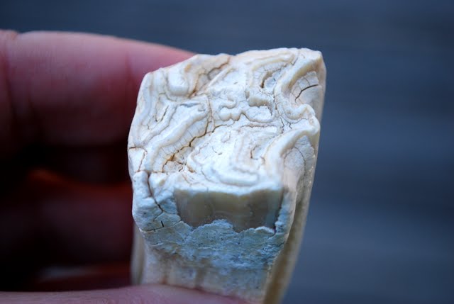 Bittersweet Bric-a-Brac: A Collection of Teeth???
