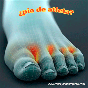 tengo hongos en los pies con heridas