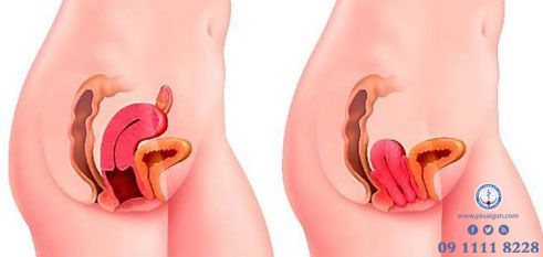 [Image: cach-dieu-tri-phu-khoa-cho-phu-nu-tai-sai-gon-3.jpg]