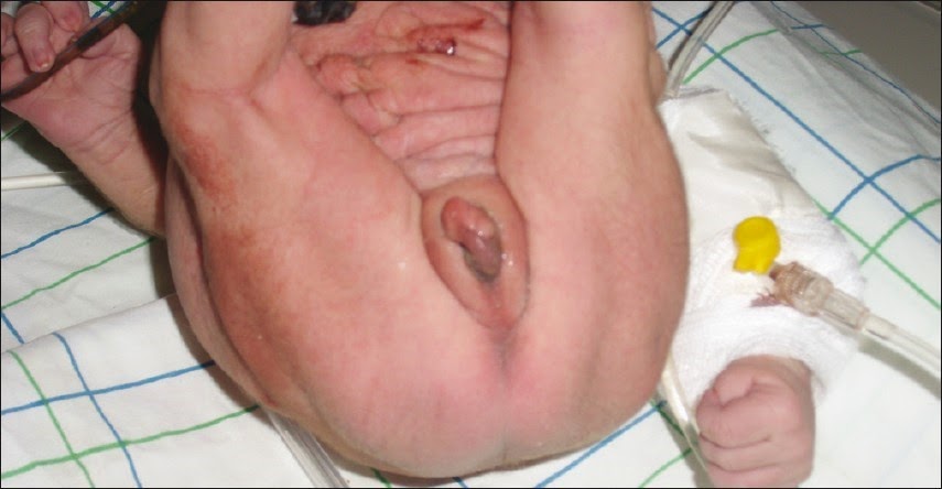 Camera into vagina on fisting How do girls jack off