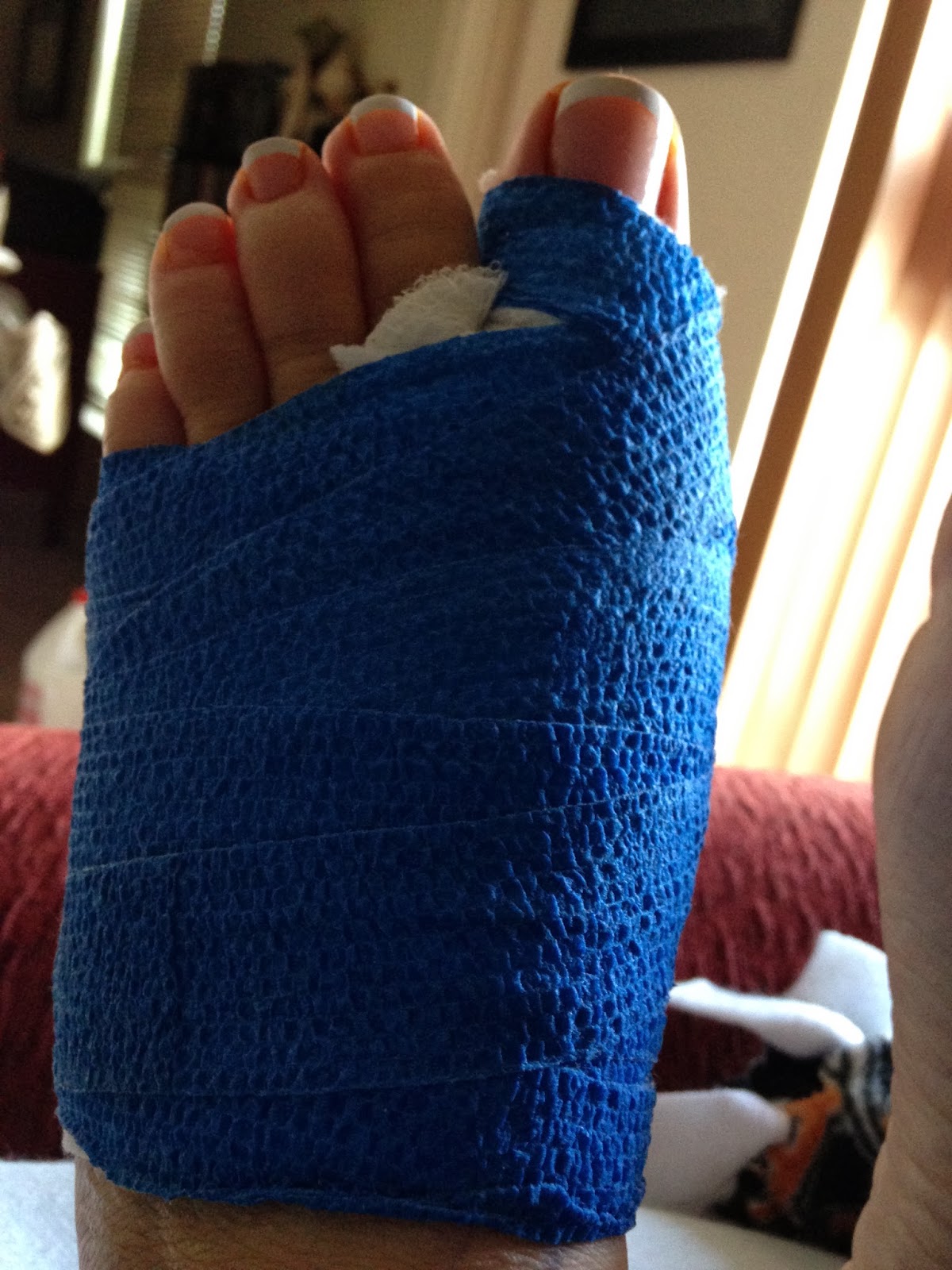 Run KW Run Thoughts on a Broken Paw, Part 1