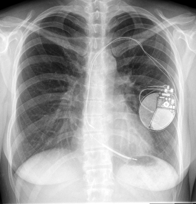 Ice Charades October is Sudden Cardiac Arrest Awareness Month this