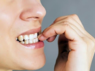 Inilah 4 Cara Alami untuk Merapikan Gigi Tonggos