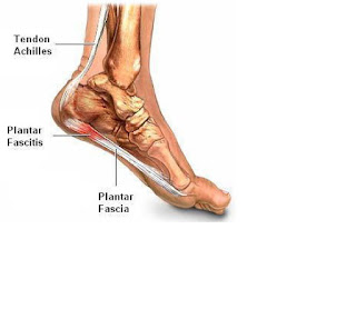 otot kaki manusia
