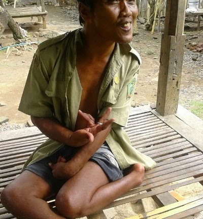 Setengah Abad Hidup Lumpuh, Luput Gelontoran PSKS