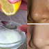 JUST BY USING 2 INGREDIENTS YOUR PORES WILL DISAPPEAR FOREVER AND YOUR FACE WILL BE CLEANER THAN EVER!