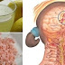 Migraine Disappears In Just 10 Minutes With This Powerful Natural Drink