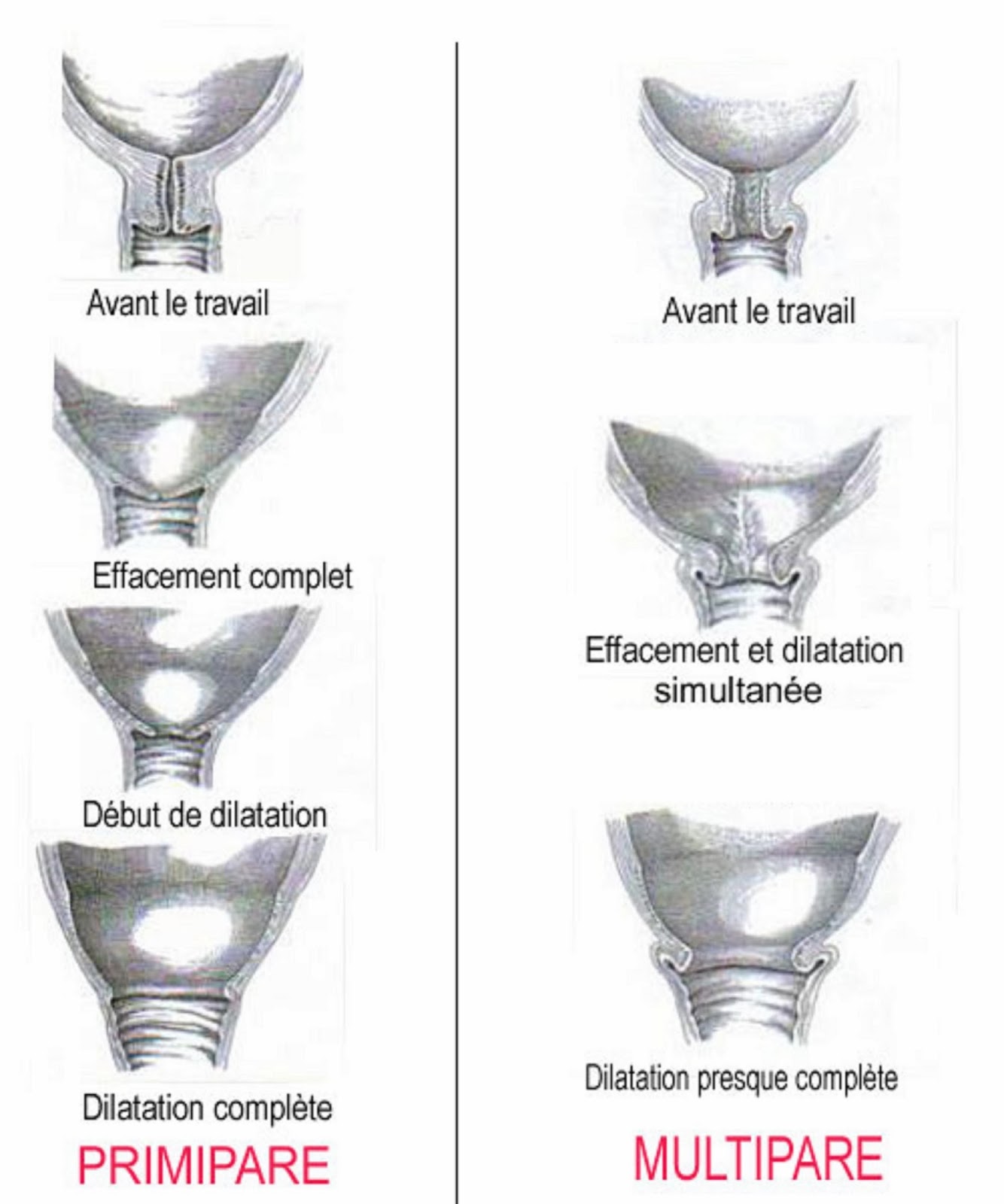 Mettre Au Monde Au Naturel Effacement et Dilatation du col phase du travail, palper abdominal