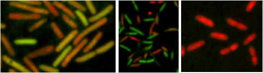 Microbial Typing with Antibiotics and Antibodies: October 2011