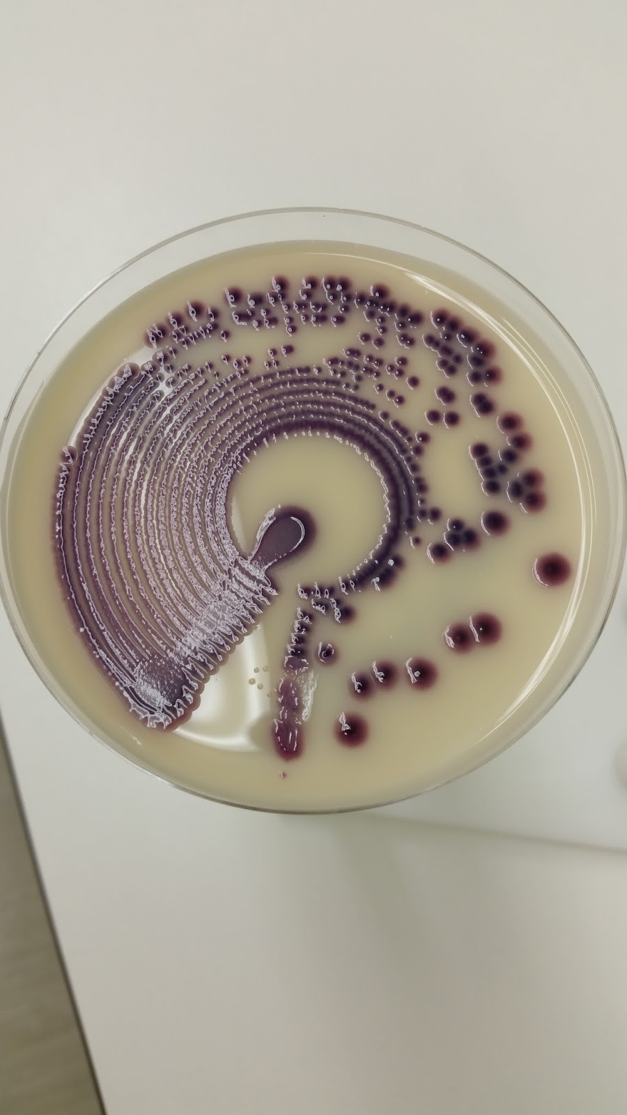 Microbiologylog Citrobacter freundii