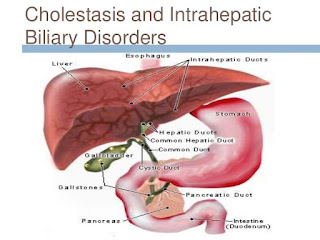 Prepare for Medical Exams : Hepatobiliary disease and Related disorders