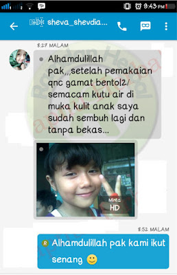 Pengobatan Kulit Bersisik, Kering Dan Gatal (Psoriasis)