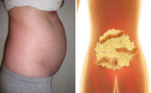 Want To Know The Real Reason Why You Have A Bloated Stomach? Here's Why! Fix It Overnight By Doing THIS! Want To Know The Real Reason Why You Have A Bloated Stomach? Here's Why! Fix It Overnight By Doing THIS!