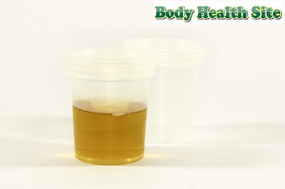 Find Out the Meaning Behind Your Urine Color